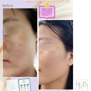 麗珠蘭細胞換活療程